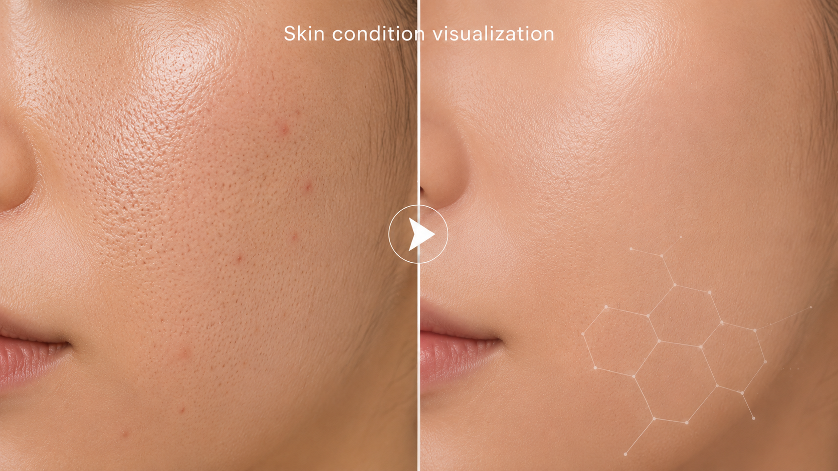 YinShun BHA Exfoliant 2% Salicylic Acid - Targeted Pore-Refining Serum for Oily & Congested-Looking Skin, Helps Minimize the look of Pores & Smooth Texture, 3.38 fl oz
